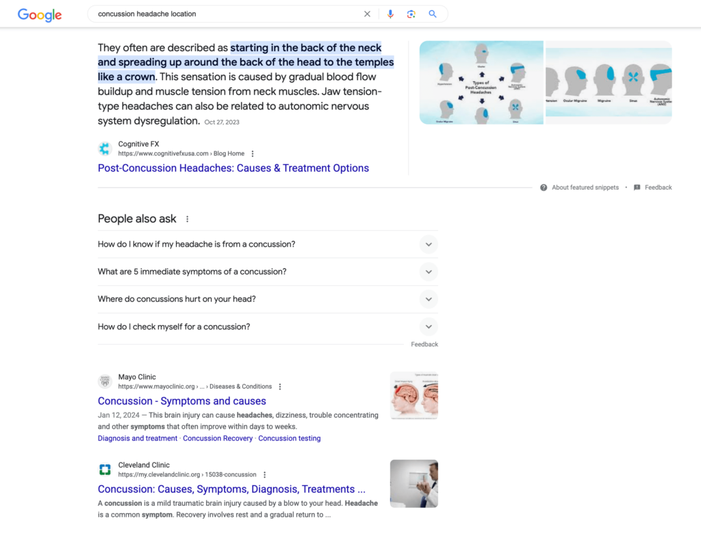 Featured snippet for our client Cognitive FX for "concussion headache location"
